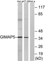 GIMAP5 Polyclonal Antibody