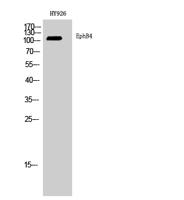 EphB4 Polyclonal Antibody