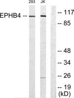EphB4 Polyclonal Antibody