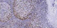EphB4 Polyclonal Antibody