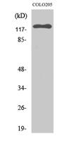 EphB6 Polyclonal Antibody