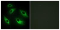 EphB6 Polyclonal Antibody