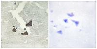 EphB6 Polyclonal Antibody