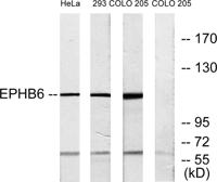 EphB6 Polyclonal Antibody