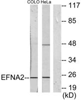 Ephrin-A2 Polyclonal Antibody