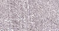 ATF-7 Polyclonal Antibody