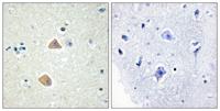 Ephrin-A5 Polyclonal Antibody