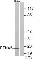 Ephrin-A5 Polyclonal Antibody
