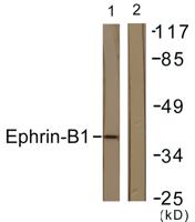 Ephrin-B1 Polyclonal Antibody