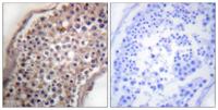 Ephrin-B1/2 Polyclonal Antibody