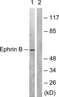 Ephrin-B1/2 Polyclonal Antibody