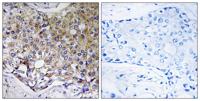 Atg4A Polyclonal Antibody