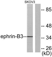 Ephrin-B3 Polyclonal Antibody