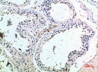 PMCH Polyclonal Antibody
