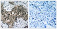Atm Polyclonal Antibody