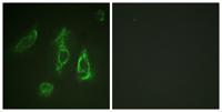 EpoR Polyclonal Antibody