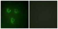 PMEPA1 Polyclonal Antibody