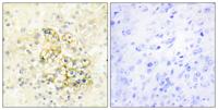 PMEPA1 Polyclonal Antibody
