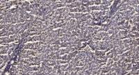 ATP5A Polyclonal Antibody