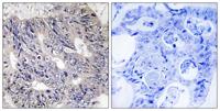 Eps8L1 Polyclonal Antibody