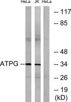 ATP5C1 Polyclonal Antibody