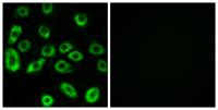 ATP5D Polyclonal Antibody