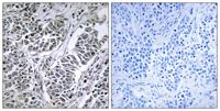 ATP5D Polyclonal Antibody