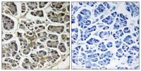 ATP5G2 Polyclonal Antibody