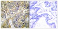 Eps8L3 Polyclonal Antibody