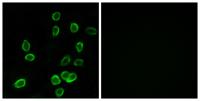 ATP5G3 Polyclonal Antibody