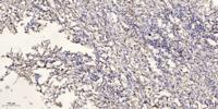 ATP5H Polyclonal Antibody