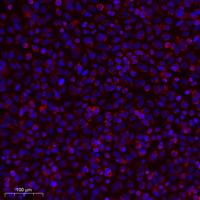 ATP5I Polyclonal Antibody