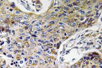 ATP5J2 Polyclonal Antibody