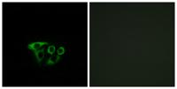 ATP5L2 Polyclonal Antibody