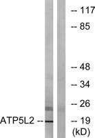 ATP5L2 Polyclonal Antibody