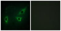 ATP7B Polyclonal Antibody