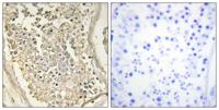 ATP7B Polyclonal Antibody