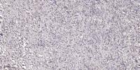 Epsin 2 Polyclonal Antibody