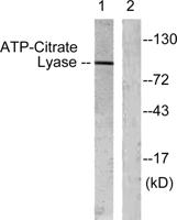 ATP-citrate synthase Polyclonal Antibody