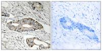 Epsin 3 Polyclonal Antibody