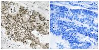 ATR Polyclonal Antibody