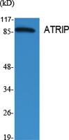 ATRIP Polyclonal Antibody
