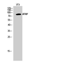 ATRIP Polyclonal Antibody