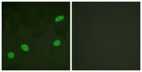 ATRIP Polyclonal Antibody