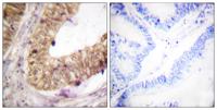 ATRIP Polyclonal Antibody