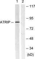 ATRIP Polyclonal Antibody