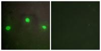 ATRX Polyclonal Antibody