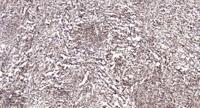 ER81 Polyclonal Antibody