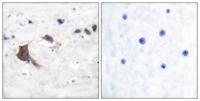 ERAB Polyclonal Antibody