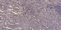 Aven Polyclonal Antibody